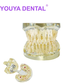 Модель зубных имплантатов, модель молочных зубов у ребенка, модель для практики, модель для обучения студентов-стоматологов, инструменты для обучения